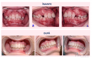 caz-ortodontie